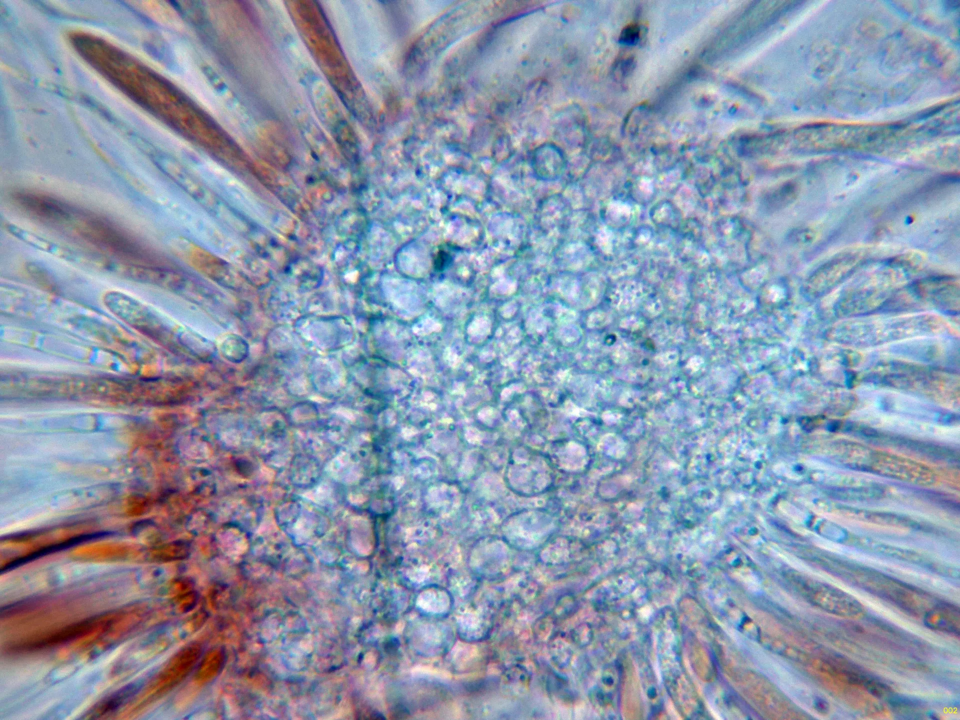Microscopía de Lophodermium foliicola - 11 - Excípulo-002